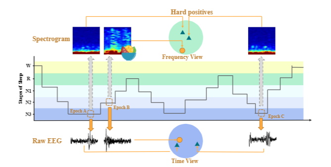 Teaser figure for: CoSleep: A Multi-view Representation Learning Framework for Self-Supervised Learning of Sleep Stage Classification